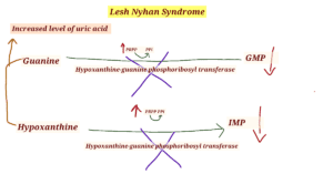 Lesh Nyhan syndrome